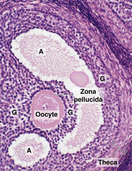 20 Resim 4: Sekonder (antral) bir folikülde oosit, ZP ve granüloza hücreleri. Henüz tam birleşmemiş antrum boşlukları (A), granüloza hücrelerinin (G) arasında görülüyor (30). 2.1.4. Preovulatuar (Tersiyer-Olgun) Foliküller (Graaf Folikülleri) İnsanlarda, 10 mm veya daha büyük bir çapa ulaşan foliküller olgun folikül olarak adlandırılır.