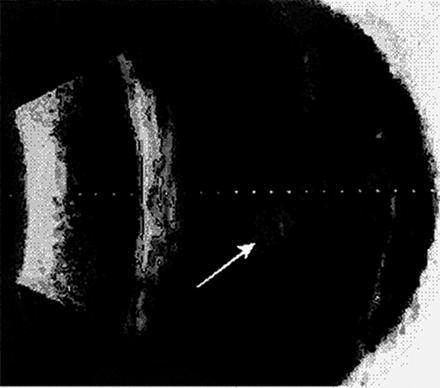 gözler olmak üzere 5 grupta sınıflandırıldı. Çalışmamızdaki ultrasonografik incelemeler BVI Compact (Prob 10 mhz) USG cihazı ile yapıldı. Veriler ortalama±sd olarak sunulmuştur.