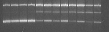 DNA hasarının ölçümü Bu formlar jel-elektroforez