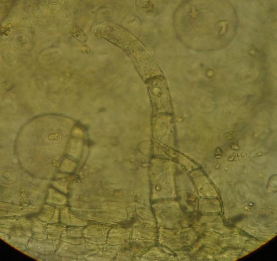 rotundifolia toz numune örneği mikroskopta incelendiğinde genel görünümde; doku parçasında geçitli üst epiderma hücreleri, palizat parenkiması, iletim