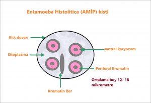 İltihabi mukus salgısı aşağıdaki durumlarda görülür ve mukus içerisinde bol PNL ve Eritrosit görülür.