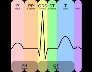EKG bulguları P amplitüdü azalır veya tamamen kaybolabilir. PR intervali uzar.
