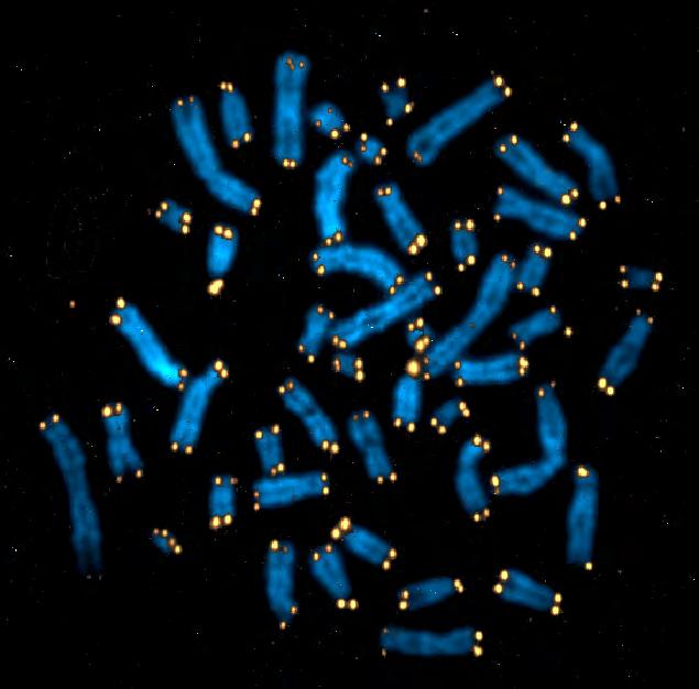 Telomeraz sayesinde Tümör Hücrelerinde Telomeraz aktivitesi durdurulursa hücreler ölür Telomerazı kodlayan gen normal hücrelerde de
