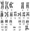 İnsan Kromozomu: 46 kromozom 44 Otozom + 2 Cinsiyet kromozomu En kısa 1 i anneden 23 çift 1 i babadan Hiç bir kromozomda band dizisi birbirine