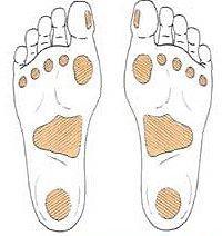 Diyabetik ayak patolojilerinde infeksiyonun sadece yumuşak doku ile mi sınırlı olduğu veya yumuşak doku infeksiyonuna eşlik eden osteomiyelitin