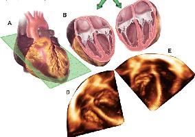 3-B EKO incelemesi için önerilen temel kesitler: Bu görüntüleme yöntemini kullanmak için, kalp aşağıdan, apeksten görüntülenmelidir.