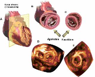 Şekil 2.1.6 Transvers (kısa eksen) kesitte kalbin bazalden ya da apikalden görünüşü (40 no lu kaynaktan alınmıştır).