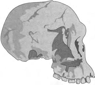 KAYl P İNSANLAR MI? ARTIK KAYlP DEGİLLER 179 niden incelendiği ve anatomik sebeplerden dolayı bir cinsten diğerine aktarıldığı bir durum varsayalım.