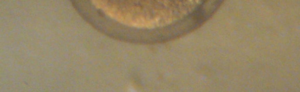 Zebra balı ının yumurta hücresi 0,7-0,8 mm çapında olup büyük bir bölümü vejetatif kutuplu yumurta kesesinden olu ur (ùekil 2.1) (Kimmel ve ark., 1995; Poleo ve ark., 2001). ùekil 2.