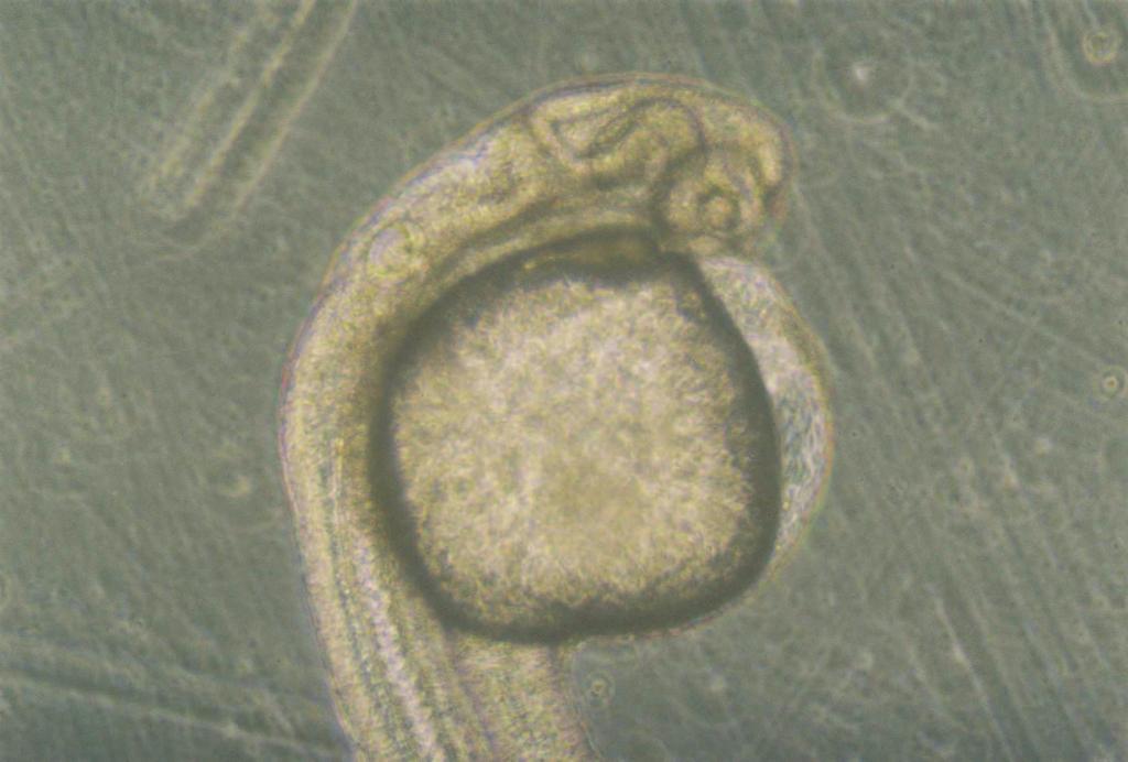54 nvert mikroskopta yapılan incelemelerde fertilizasyondan sonraki 55.