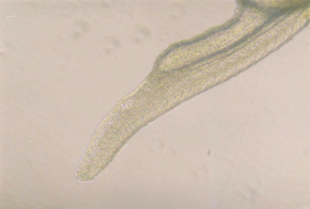 56 nvert mikroskopta yapılan incelemelerde 72. saatte haploit embriyonun kuyruk bölgesinde deformasyon ve kalınla ma tespit edilmi tir ( ekil 4.