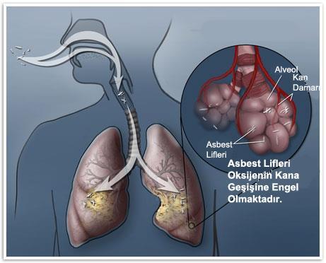 Solunum sistemi: Akciğerlerin alveoler yüzeyinin geniş olması ve çalışma ortamında bulunan pek çok