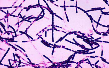 Bacillus anthracis Kültürde uzun zincirler