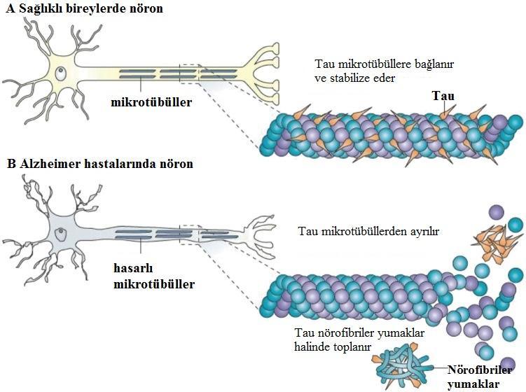 9 Şekil 3 : Alzheimer hastalarında görülen mikrotübül yapısı (42).