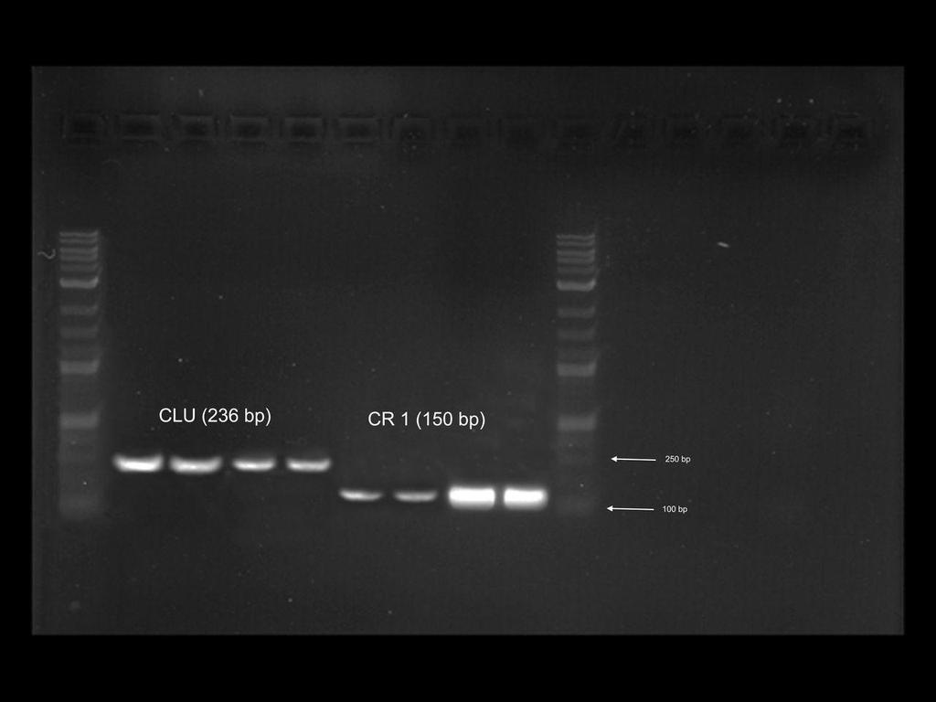 37 7 μl PCR ürününe, 3 μl yükleme tamponu (6X) eklenip pipetleme yapılarak karıştırıldı. 10 μl lik örnek karışımı kuyucuklara sırasıyla yüklendi.