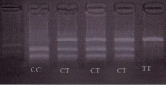 Şekil 13: CR1 geni HindIII enzim kesimi sonucunda ürünlerin %3 lük agaroz jeldeki bant görüntüsü. SORL1 geninde rs641120 C alleli varlığında Ms1I restriksiyon enzimi için kesim bölgesi oluşur.