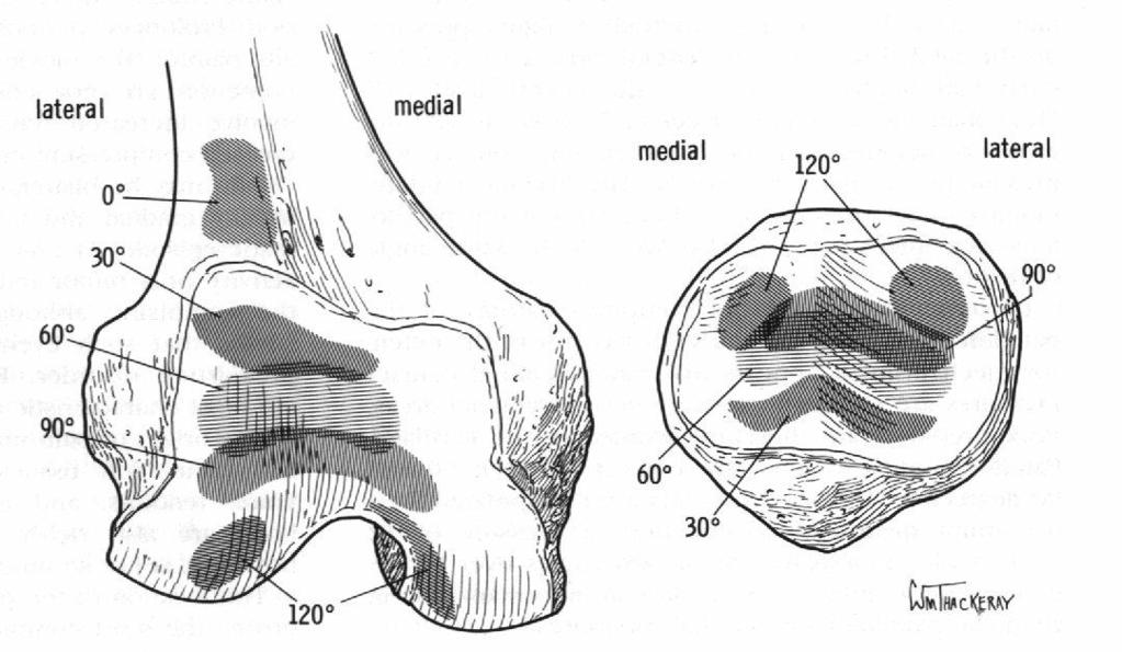 Patella ile femur'un kondilleri arasındaki yüzey hareketi, transvers ve frontal düzlemde birlikte olur.patella'da bulunan eklem yüzleri hepsi aynıanda femur ile temas etmez(şekil 1.21).