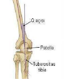 *Q açısı tayin edilirken spina iliaca anterior superior'dan patella ortasına çizilen çizgi ile patella ortasından tuberositas tibia ya çizilen çizgi arasında kalan dar açı baz alındı (Şekil 2.20).