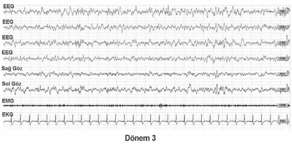 20 3. dönemde, düşük frekanslı senkronize dalgalar (delta dalgaları) ortaya çıkmaktadır. Bu dönemde delta dalgaları bir evrenin %20-50 sini oluşturmaktadır (Şekil 2.4)