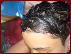 3: Hastanın saçının şampuanlanması ve durulanması Hastanın yüzü ve kulak içleri nemli temiz bezle silinerek temizlenir. Hastanın başı, üzerinde havlu bulunan yastığın üzerine alınır.