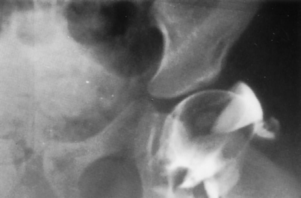 suspected intra-articular hip pathology M Christie-Large, M