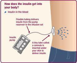 3. AŞAMA Çoklu insülin tedavisi alan ve insülin pompası kullanan