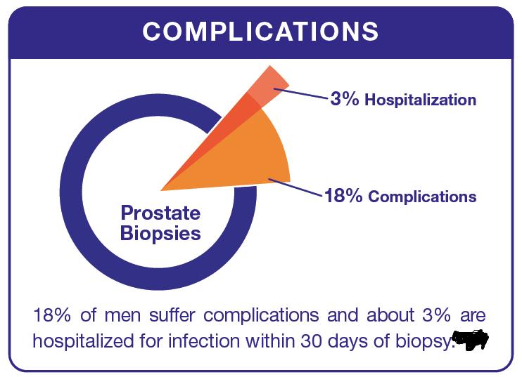 Prostat Biyopsisi İçin Hasta Seçimi Geliştirilmeli Bioyopsi, Prostat kanserinin teşhisinde