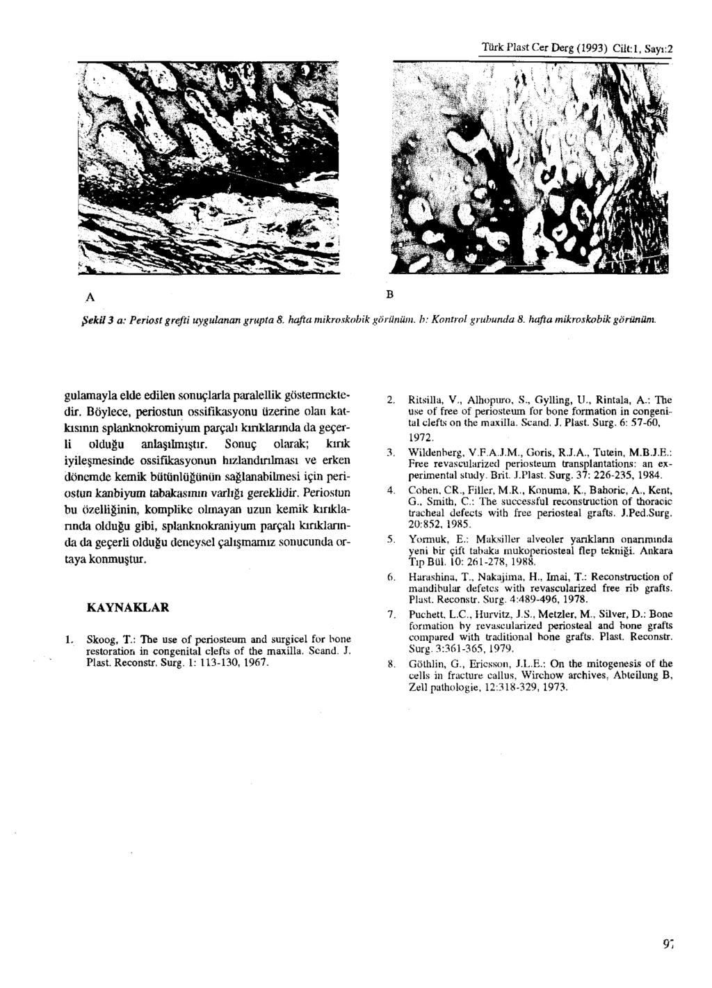 Türk Plast Cer Derg (1993) Cilt: 1, Sayı:2 A Şekil 3 a: Periost grefti uygulanan grupta 8. B görünüm, b: Kontrol grubunda 8. hafta mikroskobik görünüm.