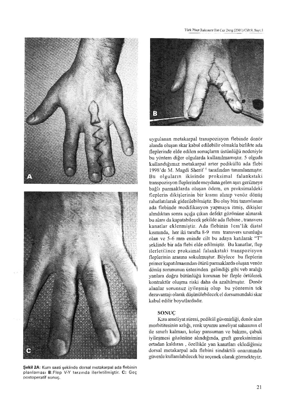 Türk Plast Rekonstr Est Cer D erg (2001) Cıli:9.