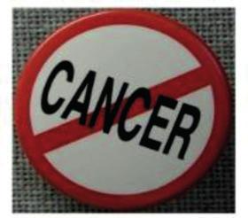 ANTI-KANSEROJEN ETKİSİ Özellikle kolon kanseri hastaları için oldukça etkili olan aronia, 2003 yılında yapılan bir çalışmada kolon kanserine karşı savaşmak için doğal bir savunma aracı
