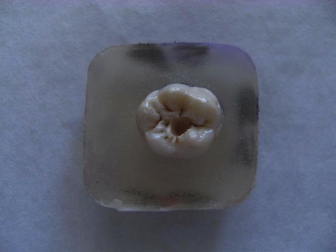 2.6. Histolojik İnceleme Ölçümler tamamlandıktan sonra mum bloklardan çıkarılan dişlerin kökleri elmas frezler yardımıyla kesildi.