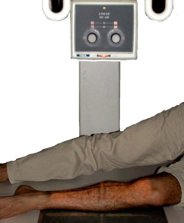 9.2.3. Pozisyon Tekniği Hasta masaya supin pozisyonda yatırılır. Radyografisi istenen bacak, önceden hazırlanmıģ kasetin üzerine alınır.