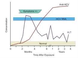 HCV tanı