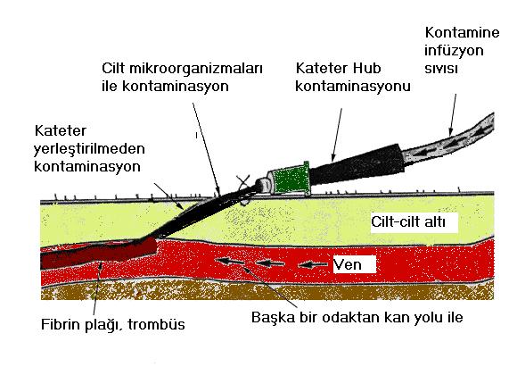 Patogenez