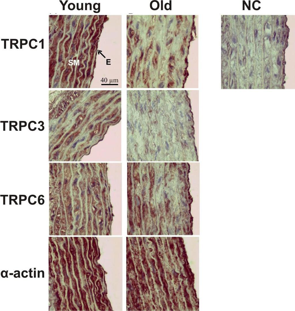 Yaşlanma sürecindeki sıçan aortunda TRPC protein