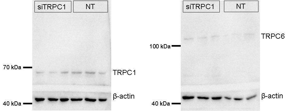 CyPB expression TRPC1 geni susturulmuş A7r5 hücrelerinde TRPC6 ekspresyonu