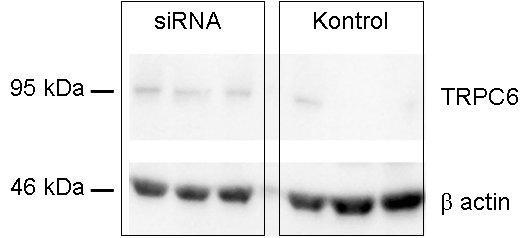 TRPC6 mrna/ actin in vivo sitrpc1 uygulanması: TRPC6 ekspresyonu aortta artmaktadır 50