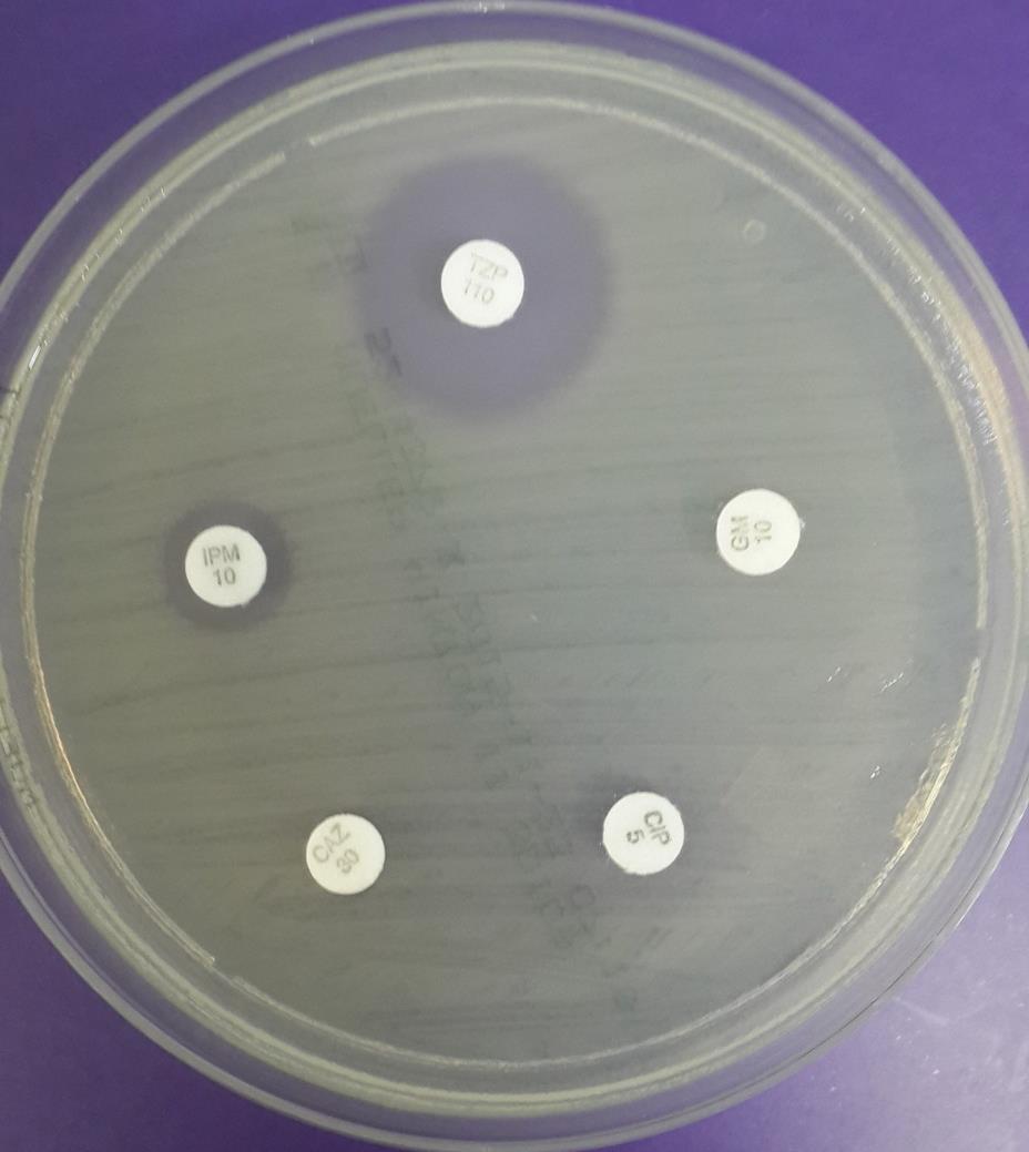 CLSI ya göre Antibiyotik Disk İçeriği µg Seftazidim 30 R İmipenem 10