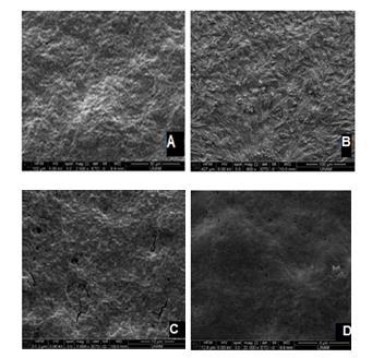 nanopartikül ilavesi sonucu elde edilen SEM mikrografları verilmiştir.