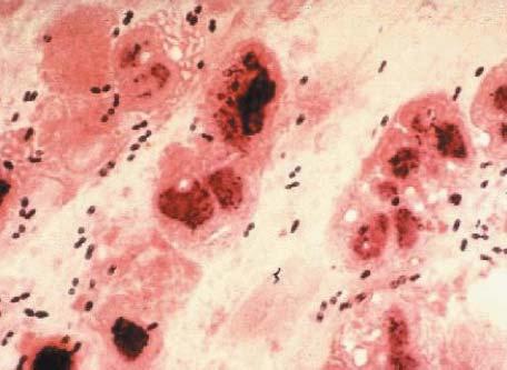 İç Hastalıkları Dergisi 2007; 14(3): 125-130 Derlemeler/Reviews Erişkinlerde Pnömokok İnfeksiyonlar : Mikrobiyoloji Dr.
