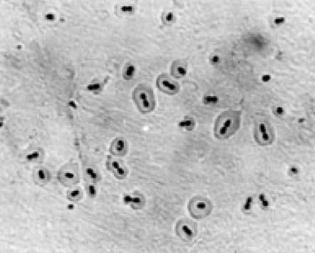 Gür D S. pneumoniae n n polisakkaridden oluşan bir kapsülü vard r. Kapsül, S. pneumoniae da virülans n en önemli faktörlerinden biridir; hücreyi fagositozdan korur.