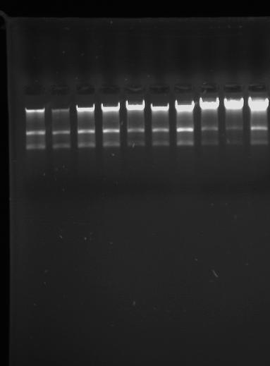 75 3. SONUÇLAR VE TARTI MA 3.1 RNA zolasyon Sonuçlar Çal mam zda tüm kan örnekleri için Qiagen RNA kan izolasyon metodu kullan ld.