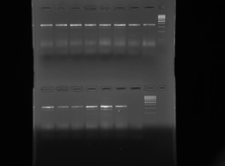 76 3.2 cdna Sentezi Real-time PCR da kal p olarak cdna kullan laca ndan, elde edilen RNA örnekleri cdna sentez kiti (Qiagen, Germany) kullan larak cdna ya dönü türüldü.