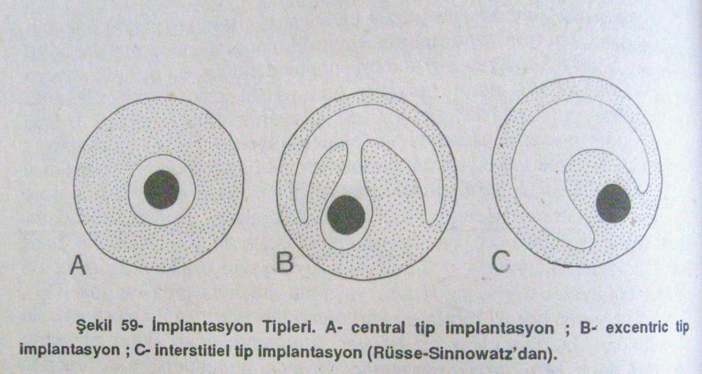 İmplantasyon Tipleri Central