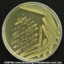 Plasmid saflaştırılması Tek kloni LB + Antibiyotik 37 C da inkübasyon Alkalin