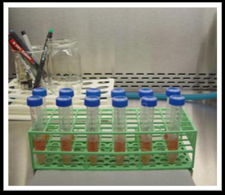 Resim 2.16. Medium içerisinde bulunan adeziv materyaller 2.2.2.3. Hücrelerin Hücre Kültür Kabına Aktarılması Hücreler, kültür kabındaki yoğunlukları % 80 e ulaģtığı zaman deney için kullanıldı.