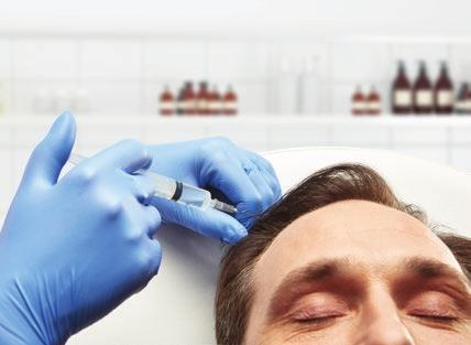 Saç Ekimi FUE isimli yöntemle yapılan ve tek bir seansta saç dökülme şikayeti yaşayan hastaların %85 inin sorununu çözen cerrahi bir işlemdir. Lokal anestezi altında yapılır.