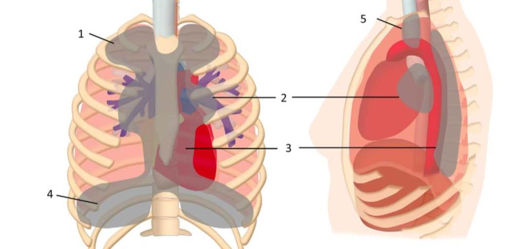 Akciğer grafisinde gözden kaçabilecek lezyonlar Üst loblar
