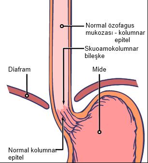 ANATOMİ Özofagus ve midenin normal iç anatomisi Normal koşullarda özofagus ve midenin iç kısmı farklı hücre tabakalarından oluşur.