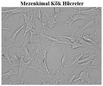 Friedenstein, mezenkimal kök hücreleri; nonhematopoietik kök hücre progenitörleri (öncüleri) olan ve fibroblast kolonisi yapan birimler (fibroblast